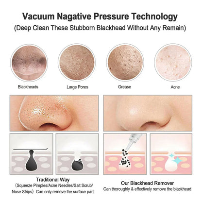Extracteur de points noirs électrique
